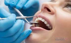 دندانپزشکی ویوان در ...
